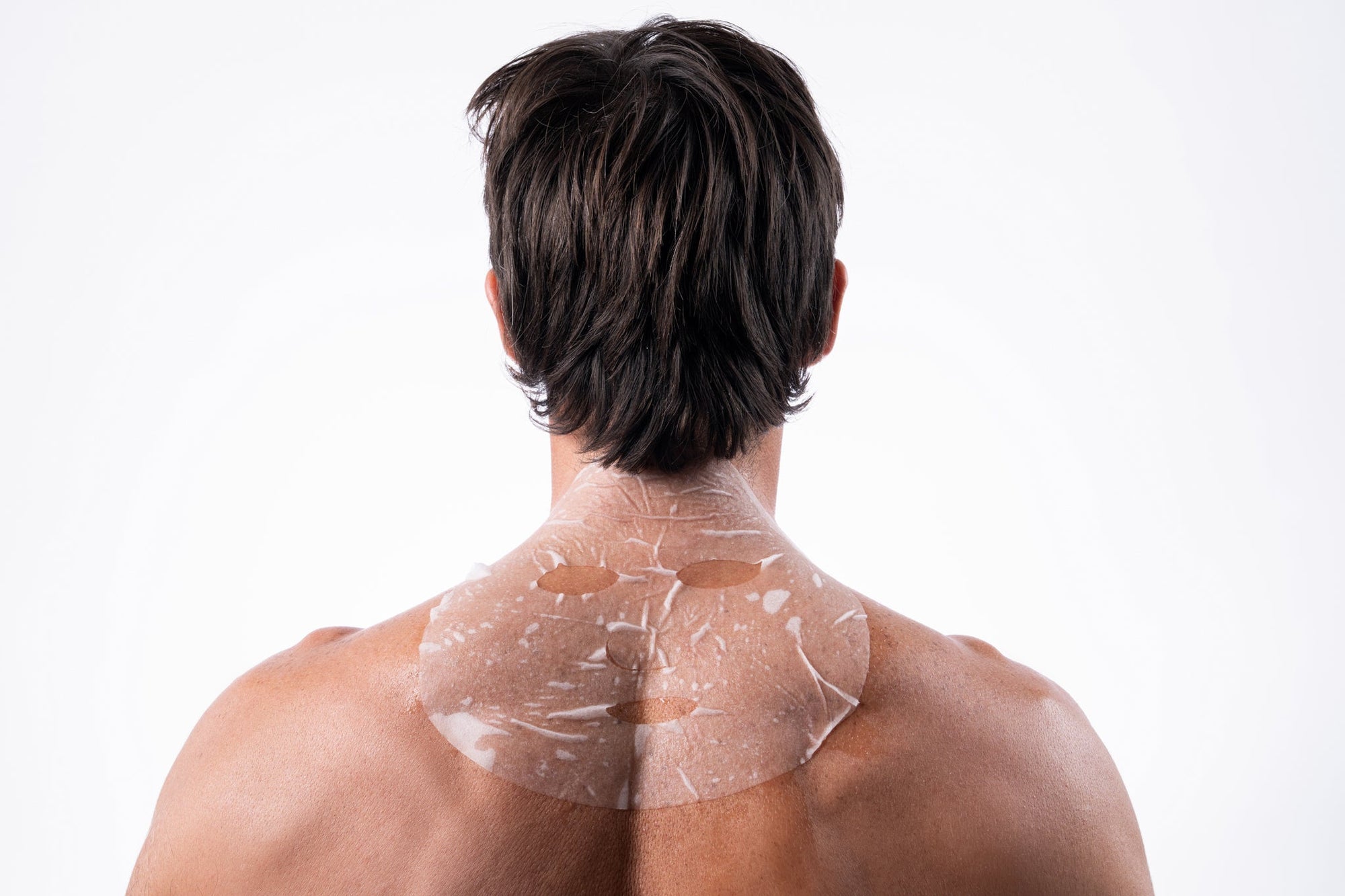 Are polynucleotides better than traditional dermal fillers?